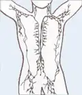 The human lymphatic system